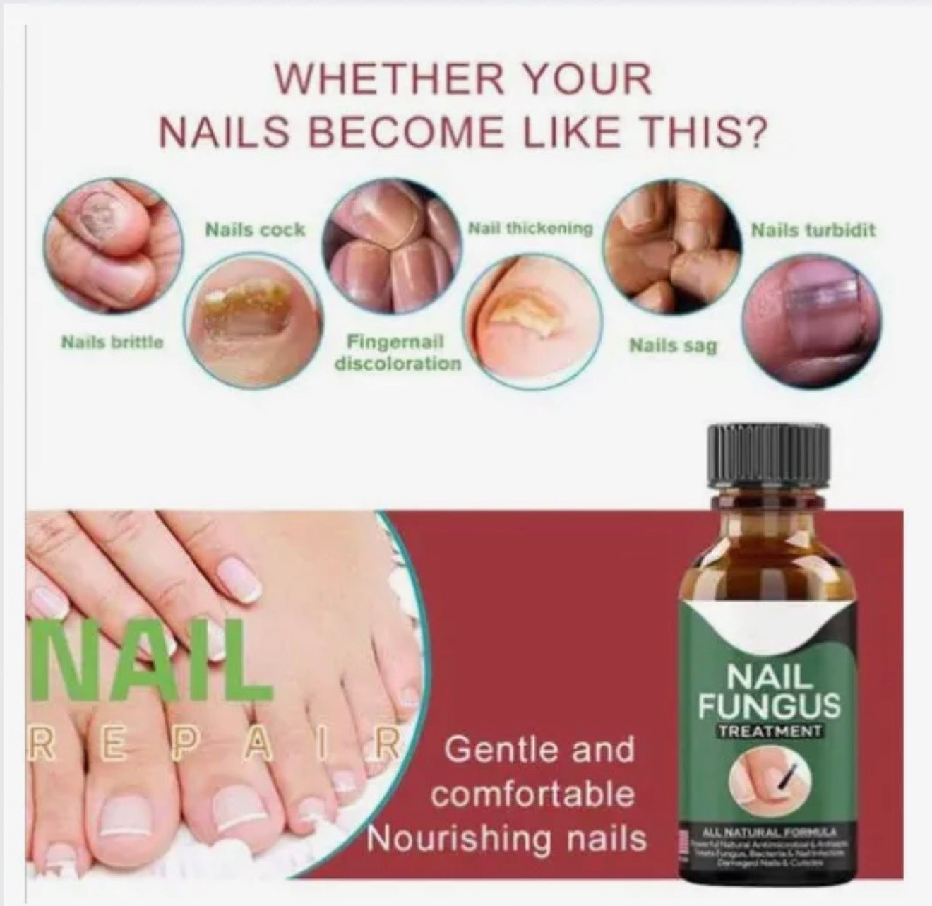 Nail Fungus Treatment Serum | Natural Formula For Finger And Toenail Care