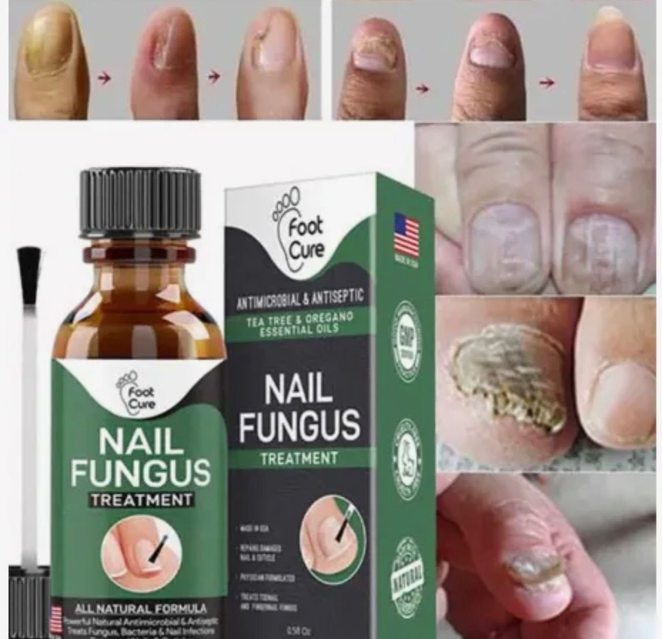 Nail Fungus Treatment Serum | Natural Formula For Finger And Toenail Care
